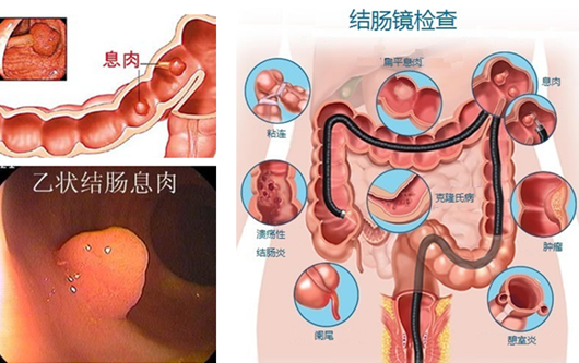 經常放屁是在“排毒”？或許“根源”在腸道！